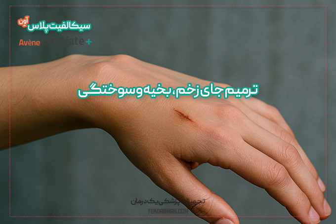 ترمیم جای زخم با سیکالفیت