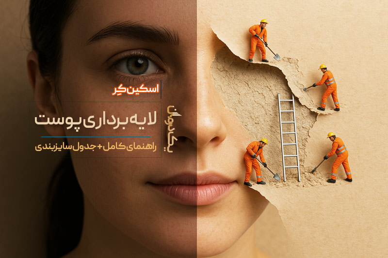 لایه برداری پوست